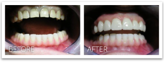 cosmetic dentistry